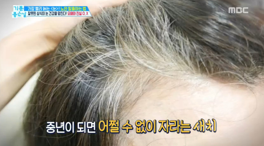 기분좋은 날 노안, 새치염색을 자주 하면 눈이 나빠진다? ··· 진실은?