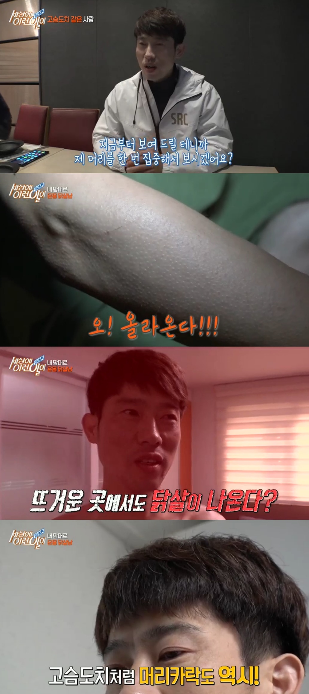 세상에이런일이 닭살남, 온 몸의 닭살 마음대로 조절 생각만 하면 된다 느낌만으로 조절 가능 황당 (3)