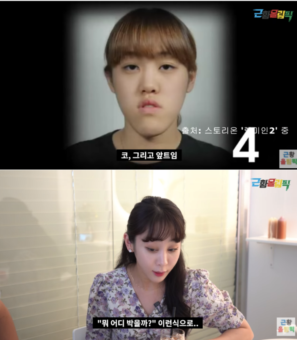 8년간 부작용이…렛미인 주걱턱녀 허예은, 근황 공개에 미모 깜짝