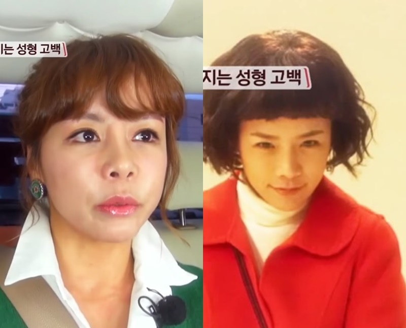영화 색즉시공 이후…배우 신이, 성형 수술 선택할 수밖에 없었던 이유