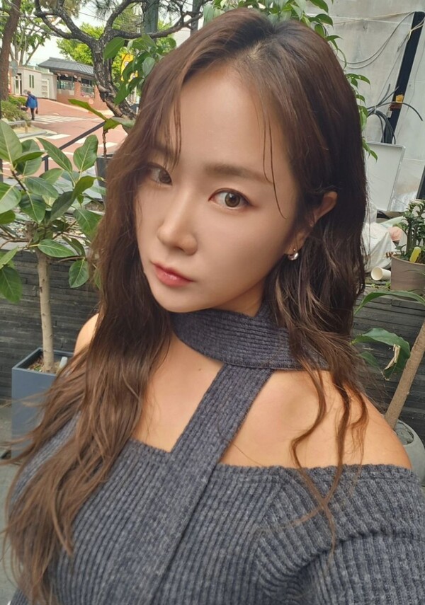 소유, 갑작스런 눈 부상 근황 순간 눈 안 보여 너무 놀라