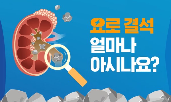 대한비뇨의학회 요로결석 얼마나 아시나요? 동영상 공개