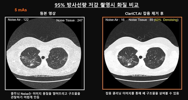 리더스내과영상의학과의원은 왜 ClariCT.AI를 도입했나?