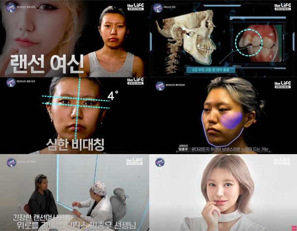 일퍼센트성형외과, 더라이프 오리지널 예능 맥미걸에 참여해 솔루션 제공