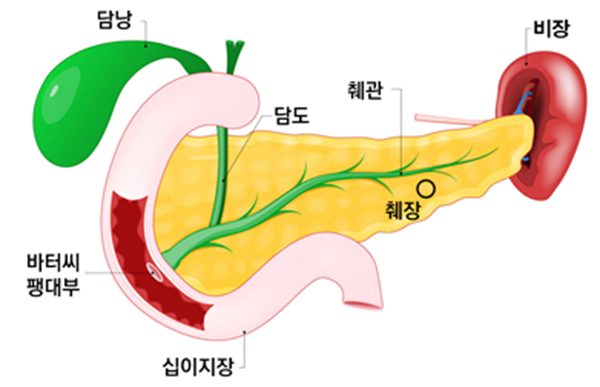 동국대학교일산병원, 로봇 췌십이지장절제술 성공