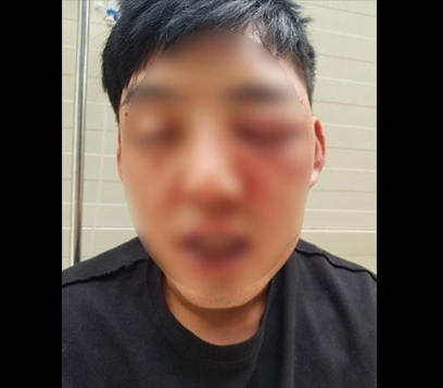 전 피겨 차오름 고소, 모델 양호석...충격적 정황