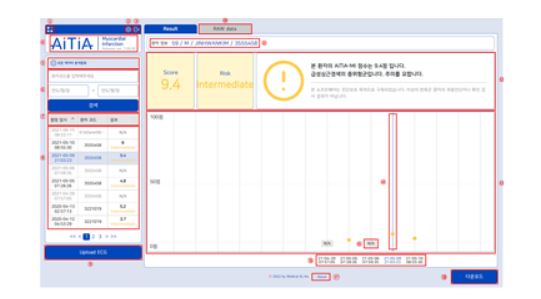 식약처 메디컬에이아이, 심전도분석SW...혁신의료기기 지정