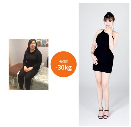 평택다이어트 전문기업 예신 오픈 진행
