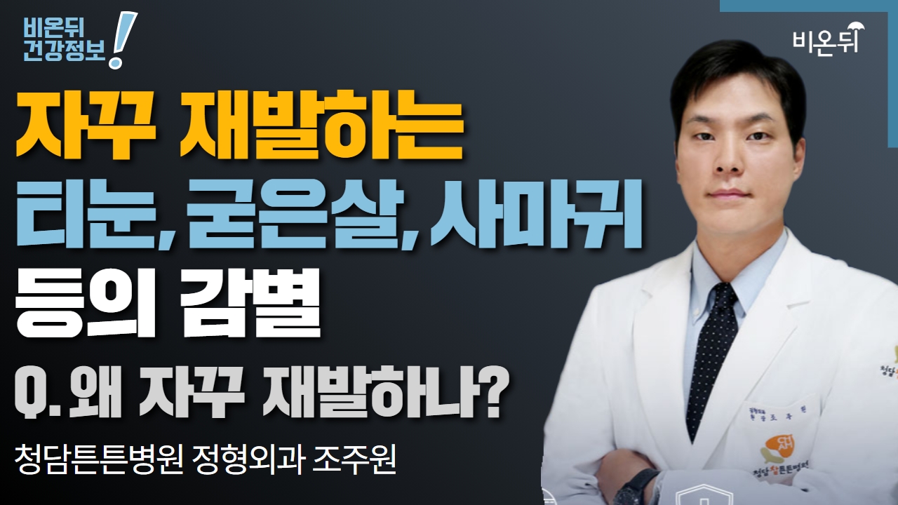 [정형외과 라이브] ‘자꾸 재발하는 티눈, 굳은살, 사마귀 등의 감별’ - Q. 왜 자꾸 재발하나? (청담튼튼병원 정형외과 조주원)