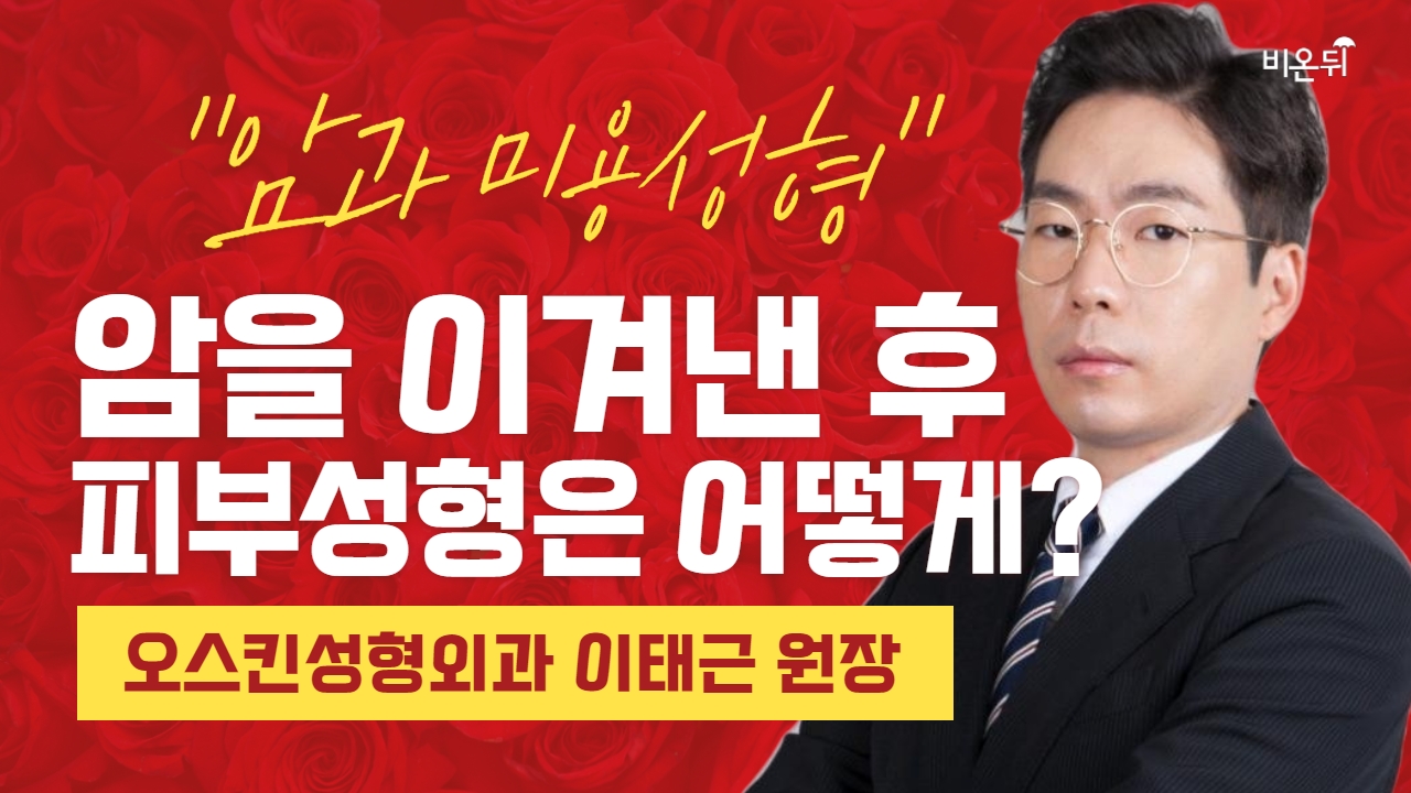 암을 이겨낸 이들의 성형수술 [대한성형외과학회 LIVE] #2 (오스킨성형외과 이태근)