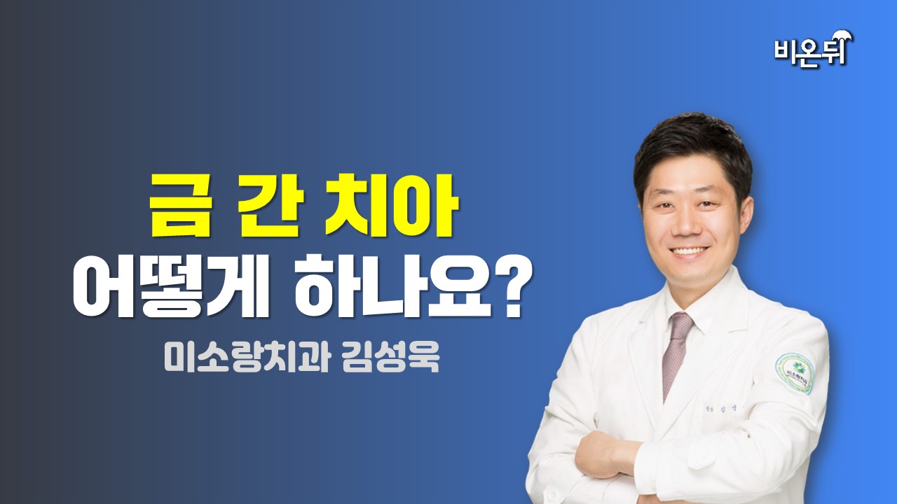 금 간 치아 어떻게 하나요? / 미소랑치과 김성욱