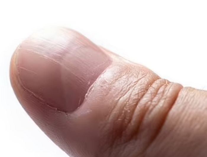 지금 당신의 손톱 모양은?...손톱으로 알아보는 건강상태 6