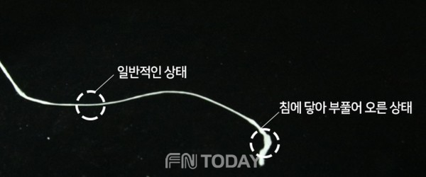 아미덴, 혁신적인 스펀지 치실 홍콩 시장에 수술