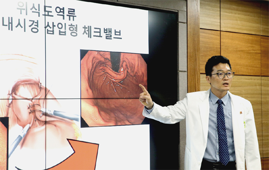 ‘위식도역류질환’, 수술이 답이다