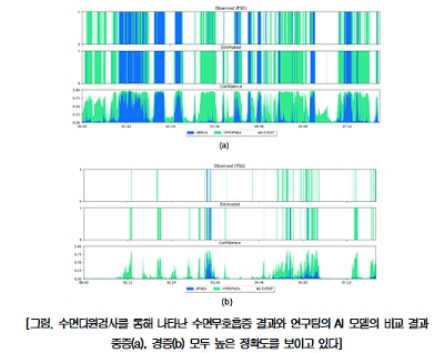 집에서도 수면무호흡 ‘실시간’ 진단 가능…소음 있는 가정에서도 정확도 86% 수준