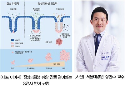 만성 위염‘장상피화생’위암 진행 관여 유전자 변이 규명