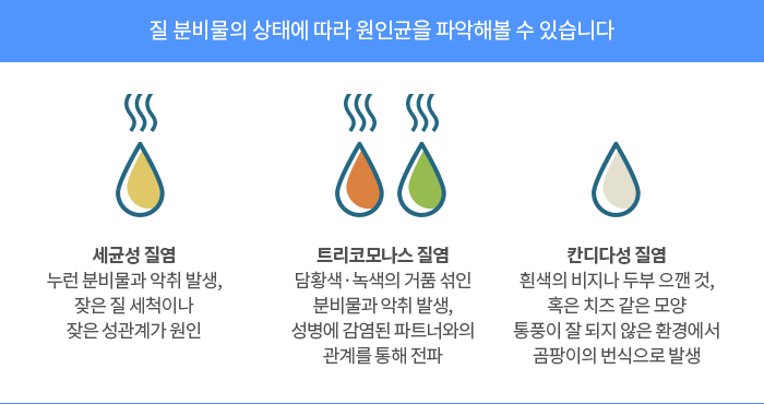 [약 이야기]질염 약은 자기 전 사용하고 질 세정제는 주 2회 이하