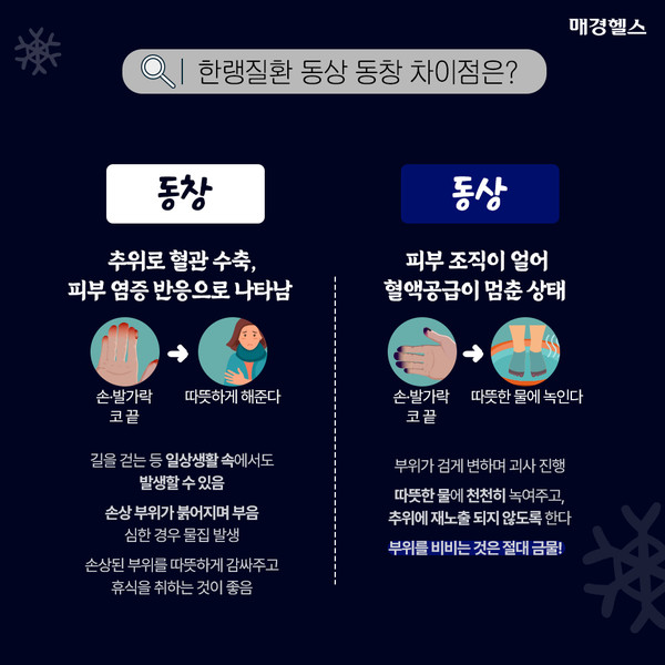 춥지 않아도 한랭질환 주의…동상·동창 차이점은?