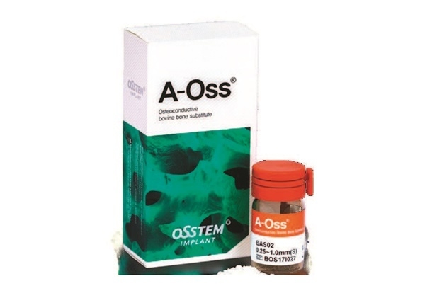 오스템임플란트 ‘A-Oss’ 인기 고공행진
