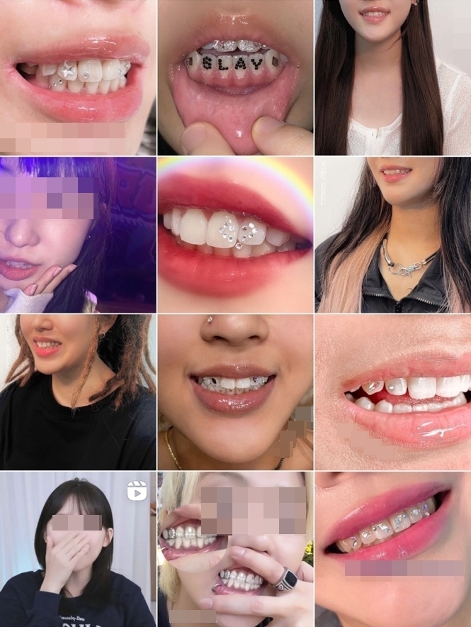 연예인 인기 업은 ‘투스젬’, 너도나도 전문가?