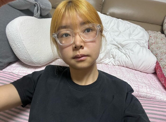 나는솔로 10기 영자, 양악 수술 한 이유가 악플때문...수입도 없고 맨땅에 타격 커