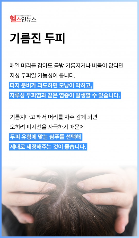 탈모 생기기 쉬운 두피 유형 4가지 [카드뉴스]