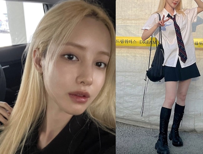 유깻잎, 안면윤곽으로 얼굴 확 바뀌고 자신감‥스쿨룩까지 도전