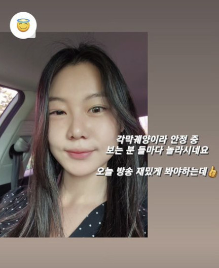 16기 영자 각막궤양 진단, 퉁퉁 부은 눈 어쩌나 “보는 분마다 놀라”